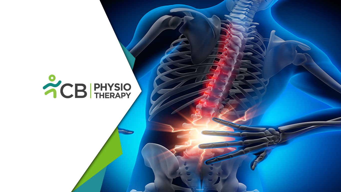 Beyond Disc Problems: How Treatment At Cb Physiotherapy Prevents Back Pain From Recurring?