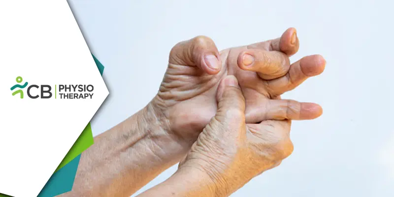 Easing The Grip | The Role Of Physiotherapy In Treating Trigger Finger