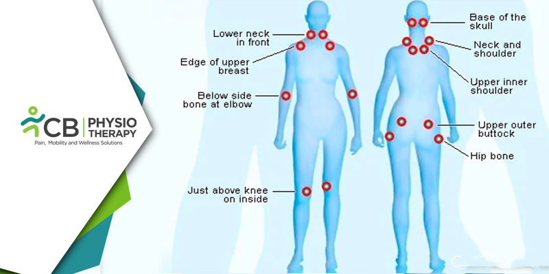 Fibromyalgia: Management Of Chronic Pain And Fatigue By Physiotherapy