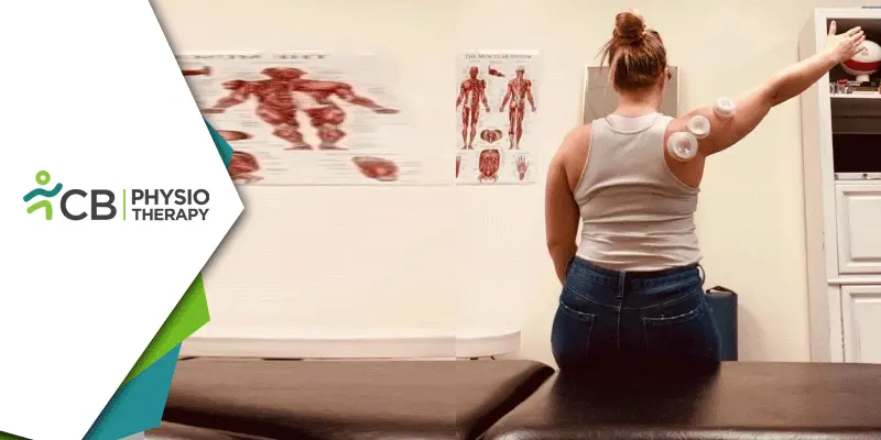 Functional Cupping In Physiotherapy | Enhancing Mobility And Promoting Effective Recovery