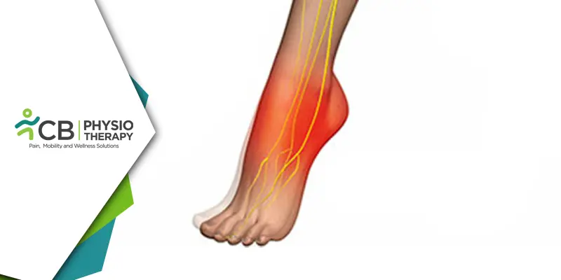 Managing Foot Drop In Spondylolisthesis | Effective Physiotherapy Techniques For Improved Mobility And Quality Of Life