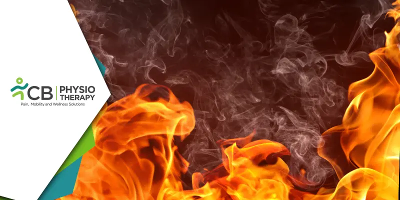 Post-burn Physiotherapy: Rehabilitation Of Patients From Third-degree Burns
