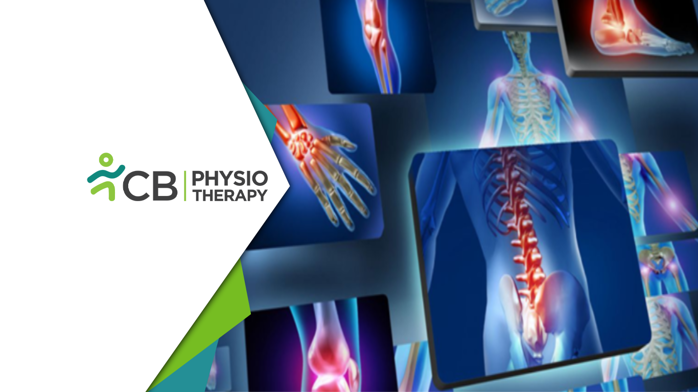 Recurrent Musculoskeletal Pain | How Holistic Physiotherapy Unlocks Lasting Relief And Resilience