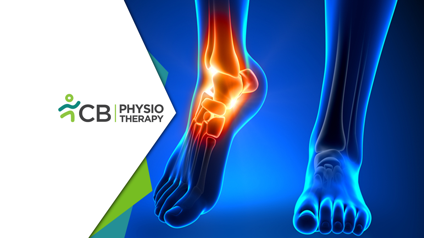 Why Frequent Ankle Sprains Never Really Heal | How Cb Physiotherapy Restores True Stability?