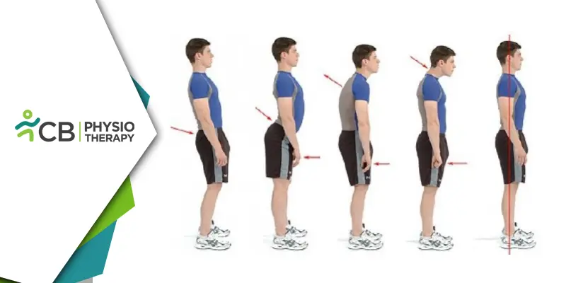 Why Posture Matters | How Physiotherapy Posture Assessment And Correction Can Prevent Chronic Pain And Boost Overall Health