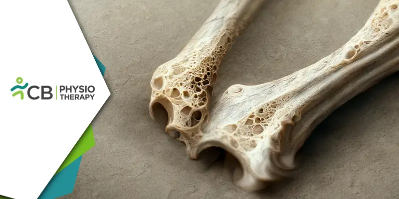 World Osteoporosis Day 2023 | Unveiling The Vital Role Of Physiotherapy In Strengthening And Managing Bone Health