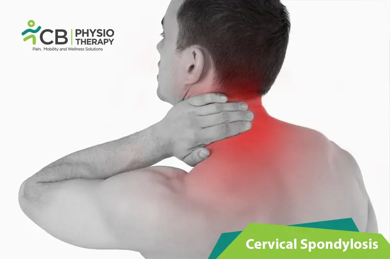 Cervical Spondylosis