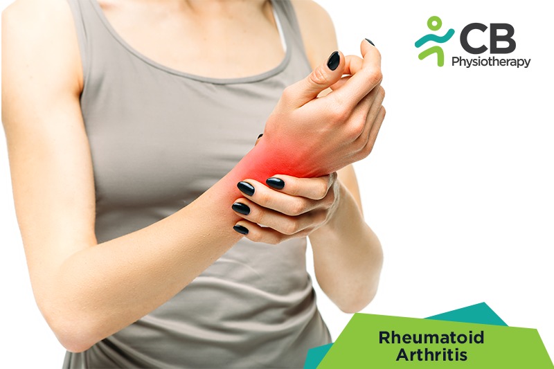 Rheumatoid Arthritis