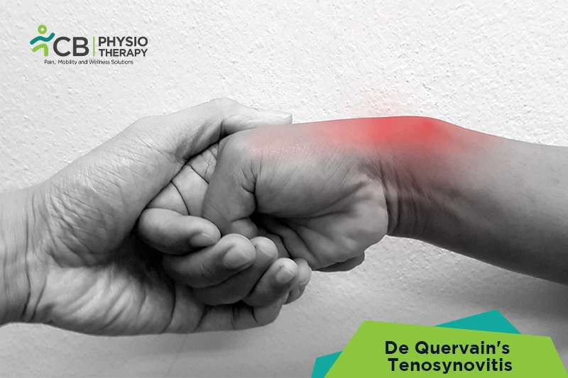 Top 5 Exercises For De Quervain's Tenosynovitis