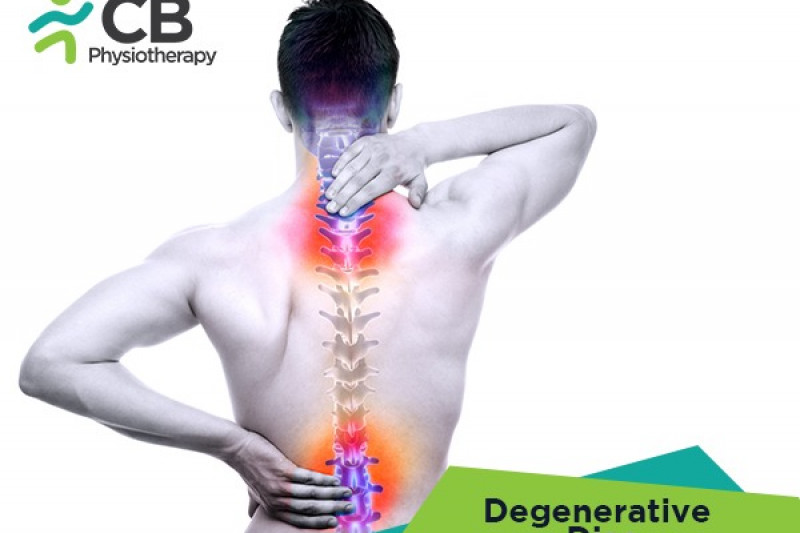 Top 5 Exercises For Degenerative Disc Disease