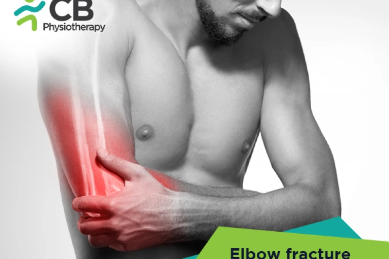 Top 5 Exercises For Elbow Fractures