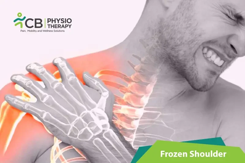 Top 5 Exercises For Frozen Shoulder