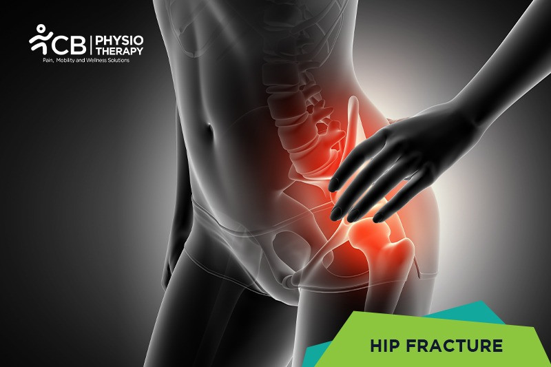 Top 5 Exercises For Hip Fracture