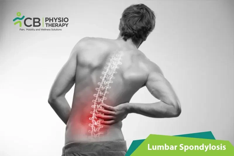 Top 5 Exercises For Lumbar Spondylosis