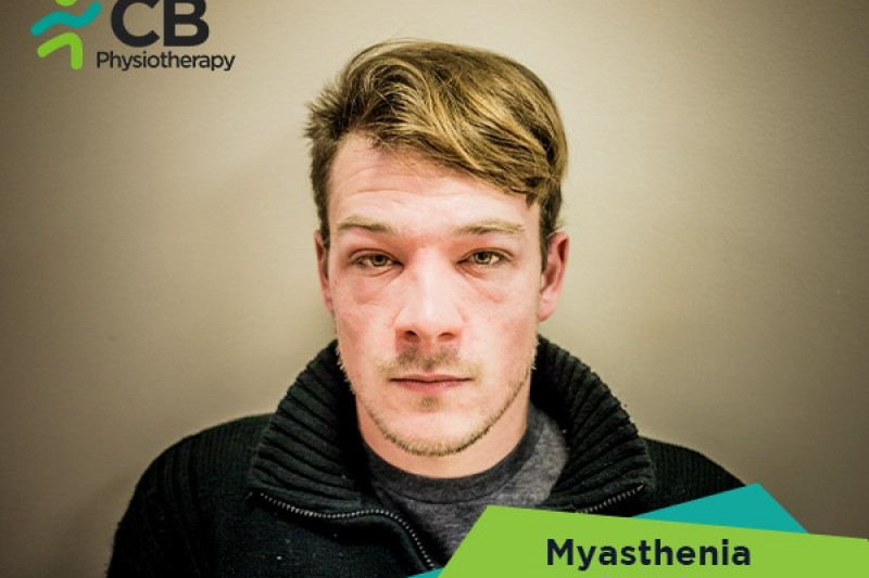 Top 5 Exercises For Myasthenia Gravis (mg)