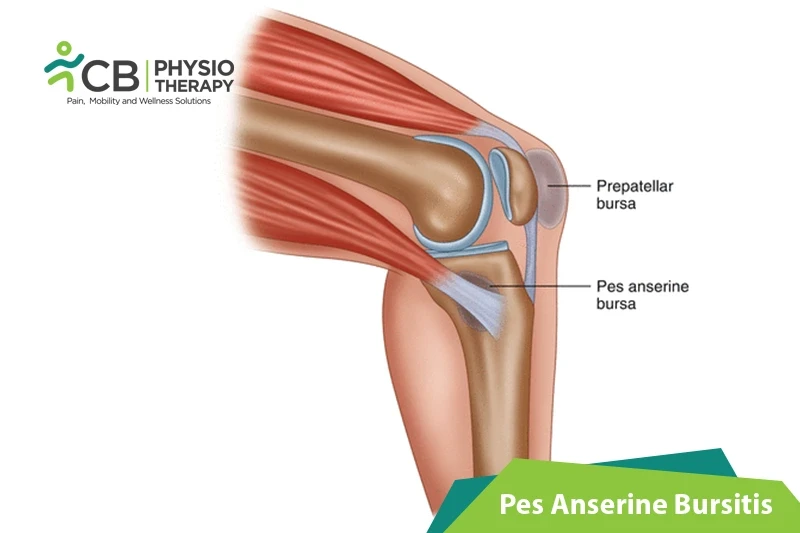 Top 5 Exercises For Pes Anserine Bursitis