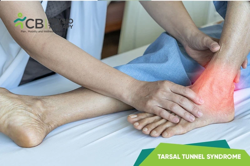 Top 5 Exercises For Tarsal Tunnel Syndrome